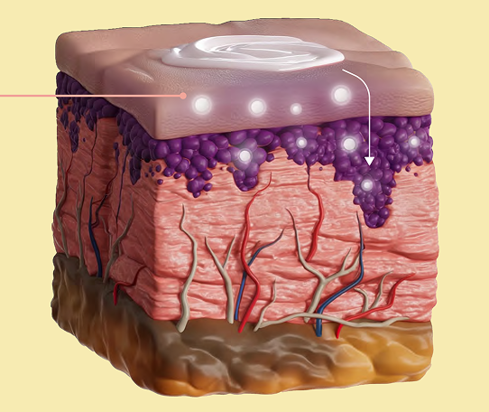 mecanismo de ação do medicamento hirudoid